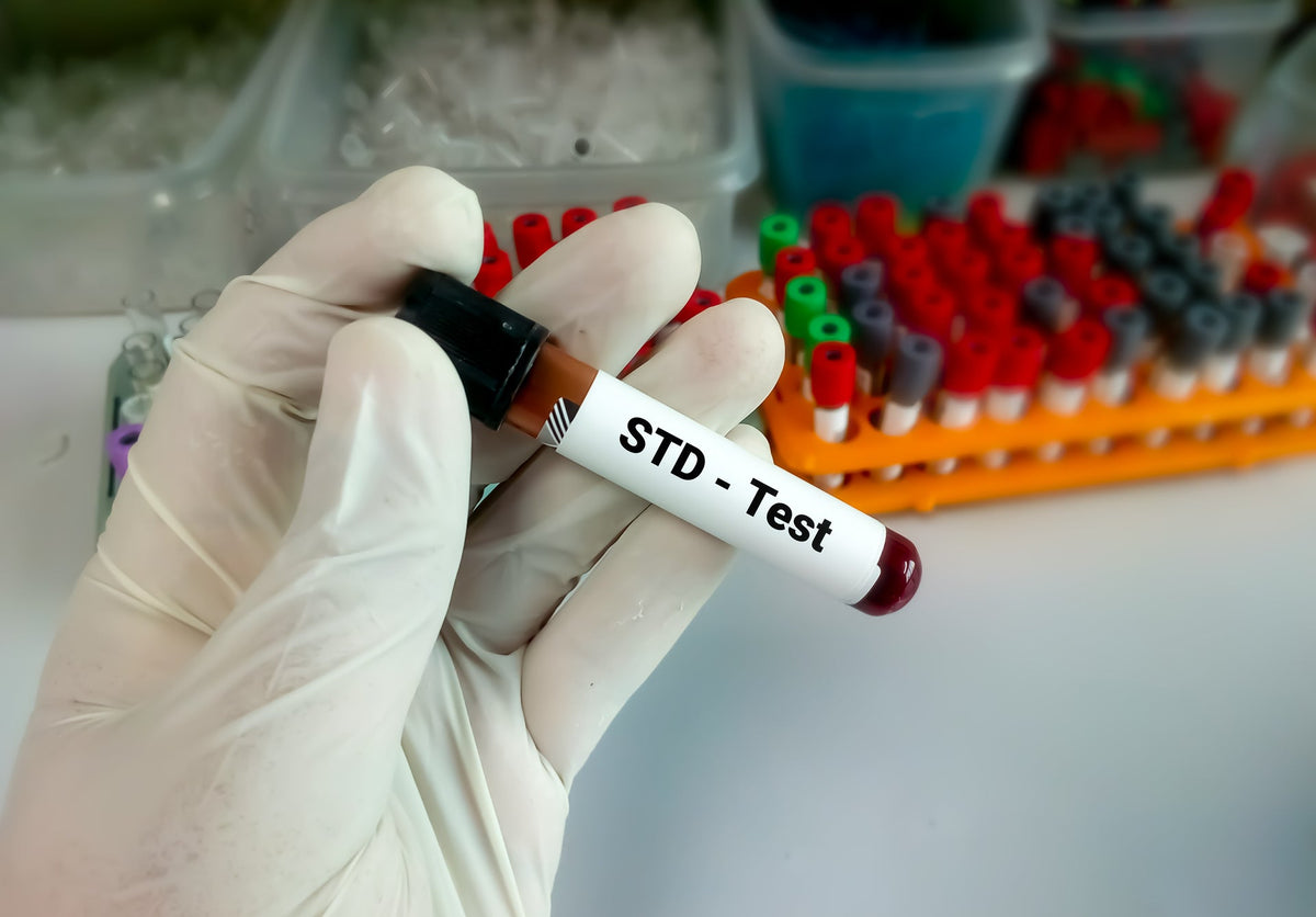 STD Test