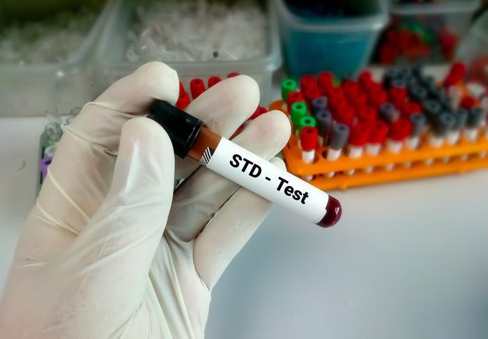 STD test