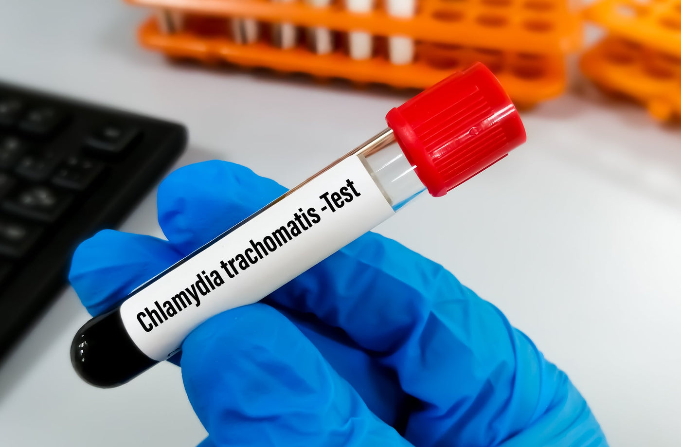Blood sample with Chlamydia trachomatis test order