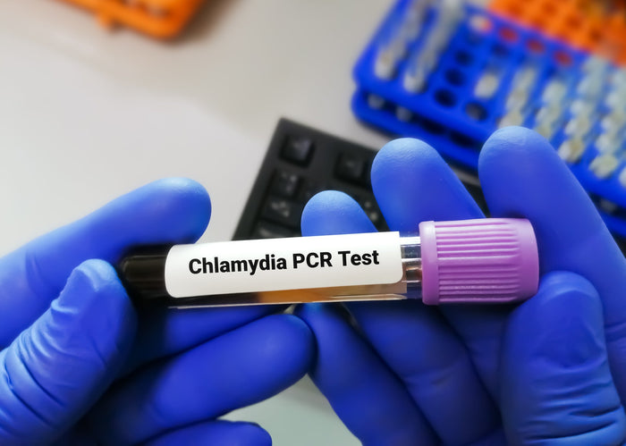 Chlamydia Test