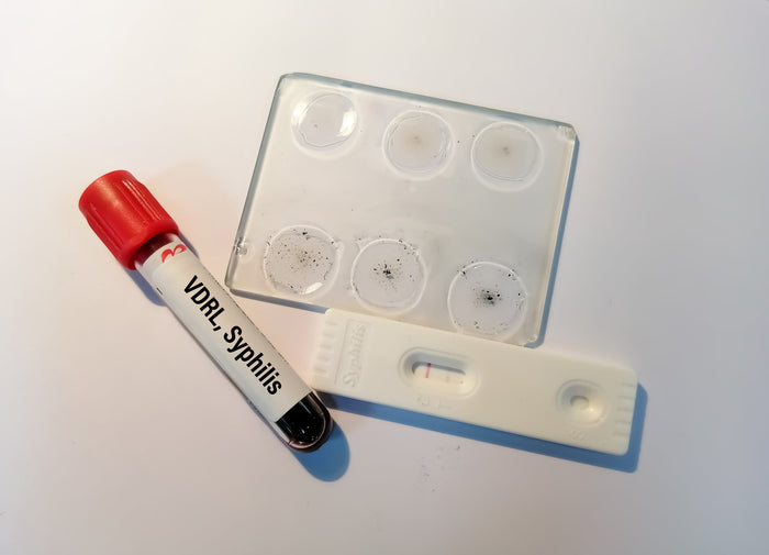 Syphilis-Test